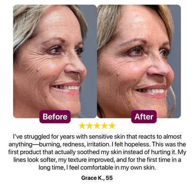 Bálsamo multiusos de calcio Cemenrete del Dr. Melaxin