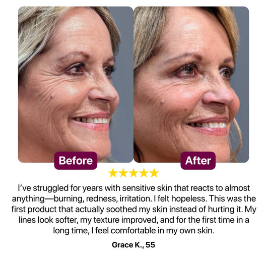 Bálsamo multiusos de calcio Cemenrete del Dr. Melaxin