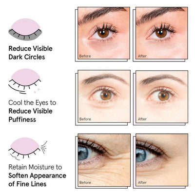 Bloomei peptide serum under eye patches